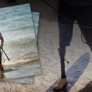 Danielle Burt at beach showcasing prosthetic leg.
